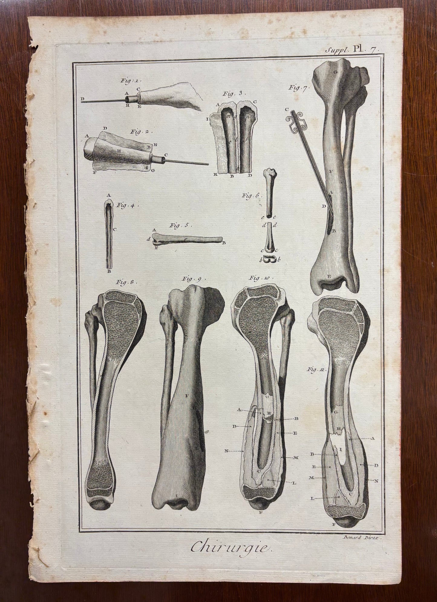 Plate 7, Long Bones by Louis-Jacques Goussier