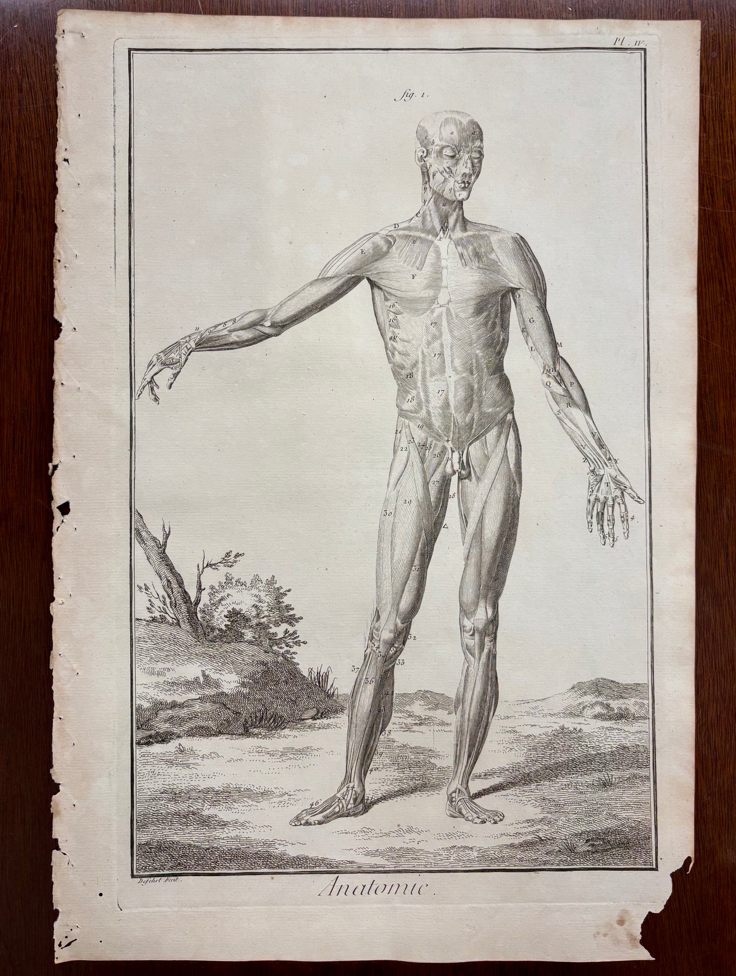 Plate IV, Anatomie by Louis-Jacques Goussier